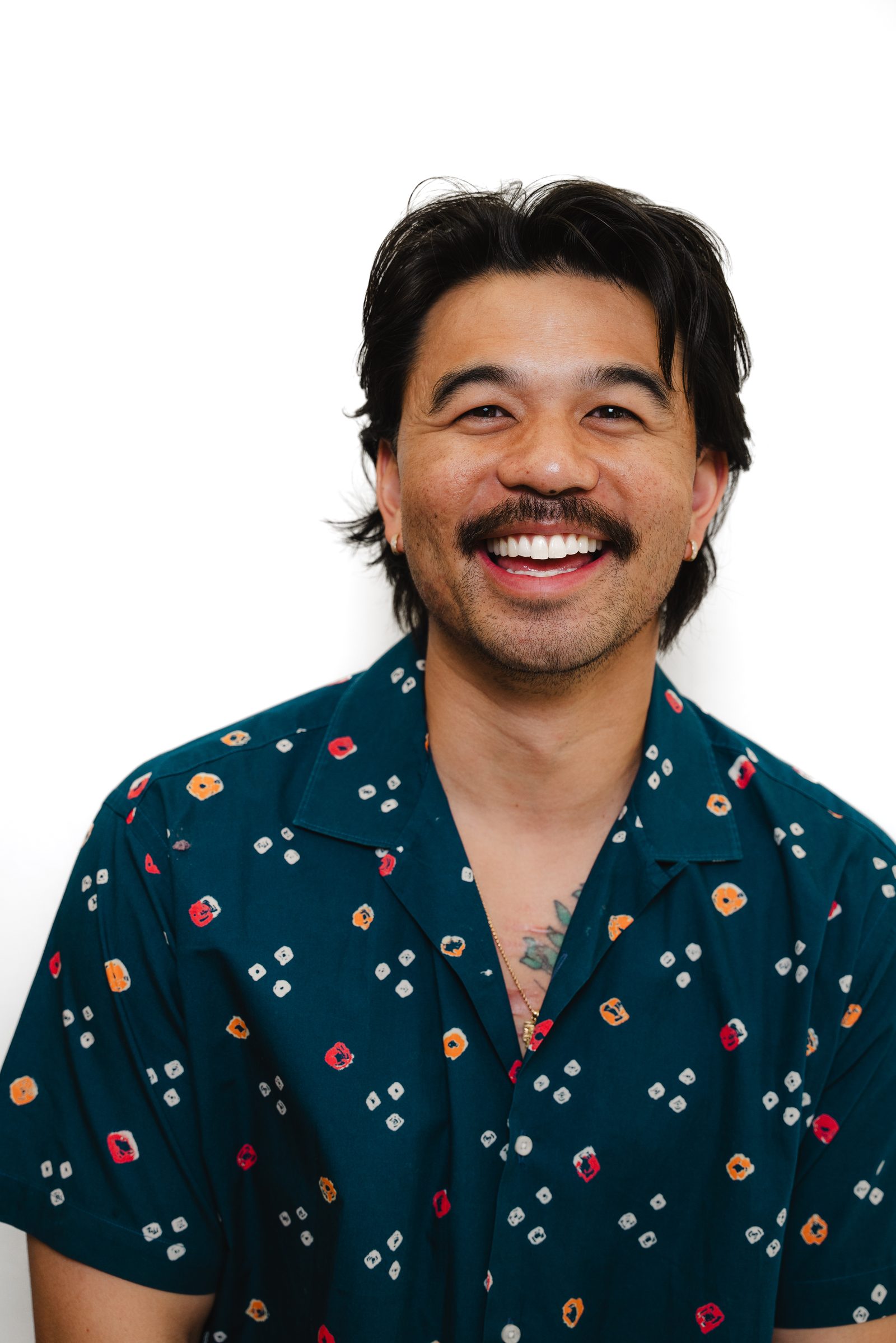 Snap-On Dentures patient at Vegas Choice Dental in Las Vegas